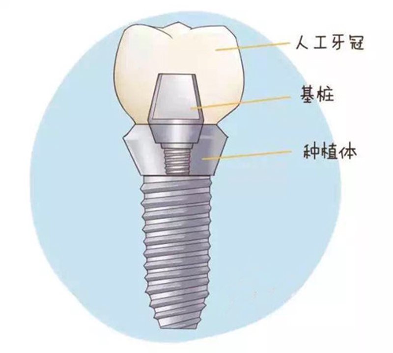 牙齿矫正的最新进展与趋势