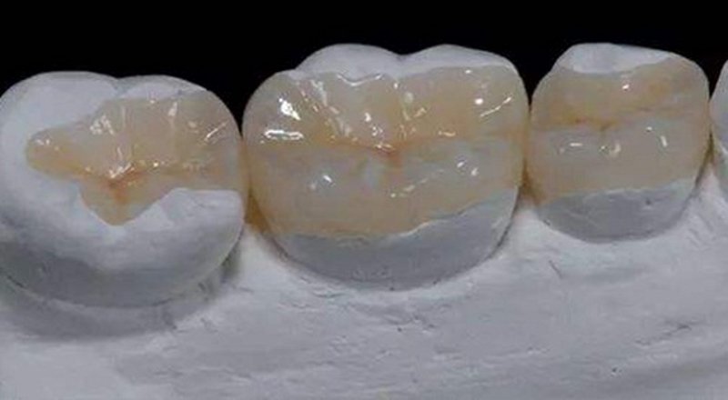 常熟牙科医疗新趋势:智慧口腔健康管理